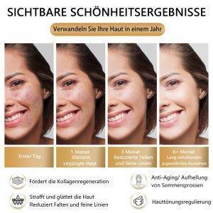 Dermaroller 7 Farben LED Gesichtsmaske mit Rotlichttherapie,Hautpflege für Zuhause Für das Gesicht, LED-Maske, Lichttherapie Maske mit 270 LEDs, Anti-Aging & Pflege